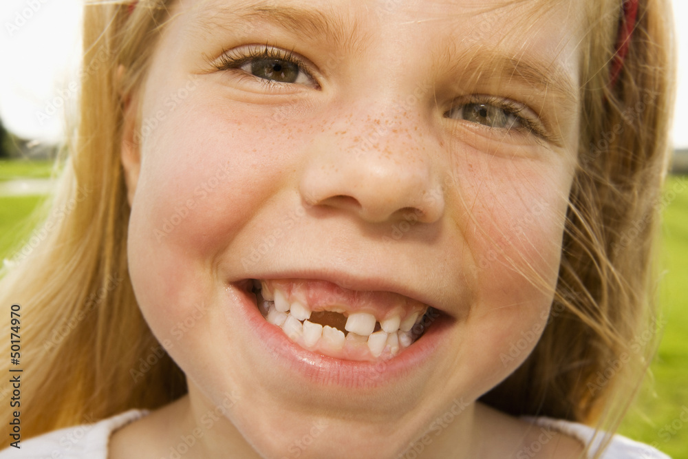 Grinning girl with tooth missing Grinning girl with tooth missing