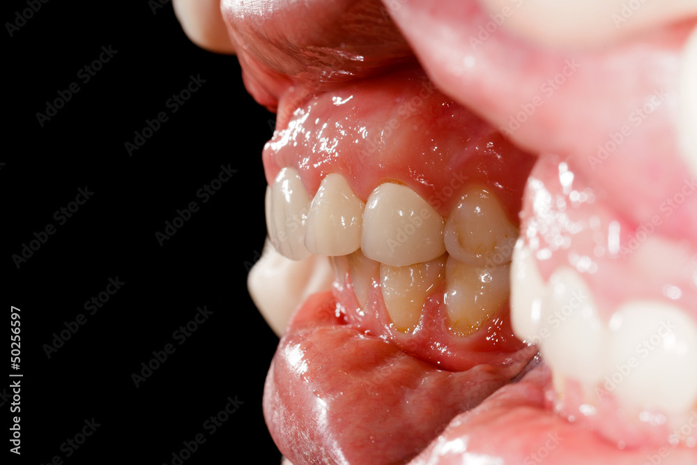 Abstract teeth