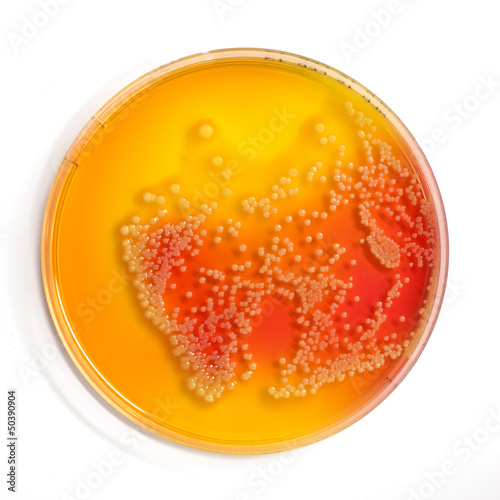 An agar plate with microorganisms
