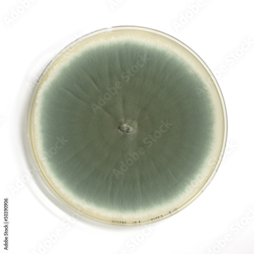 An agar plate with microorganisms