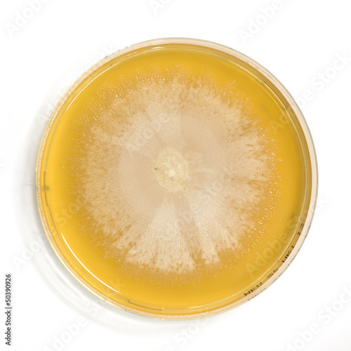 An agar plate with microorganisms
