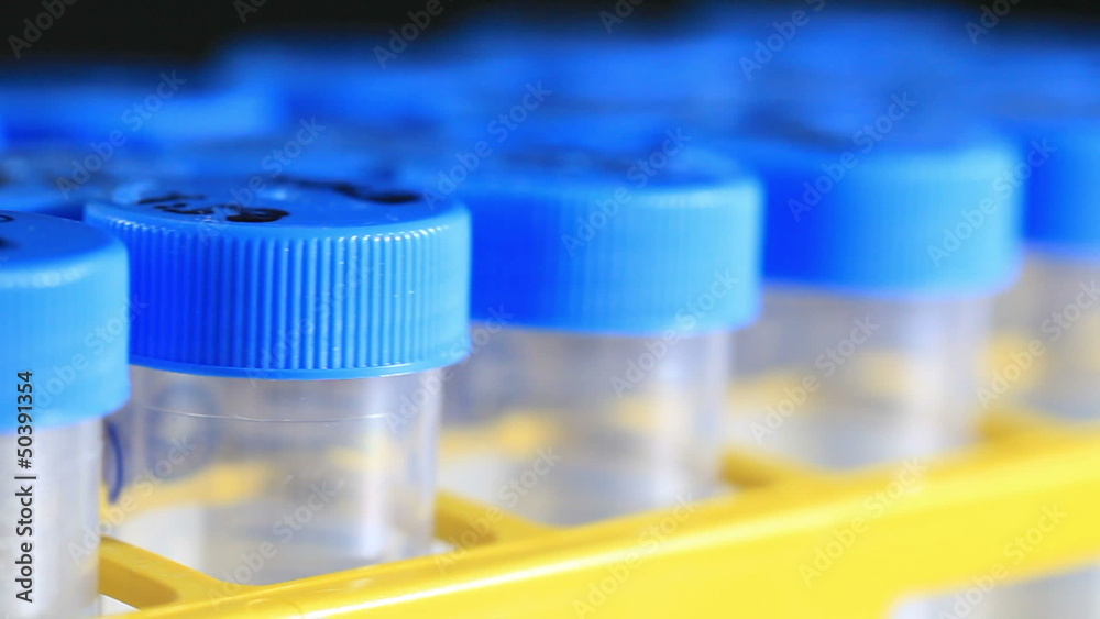 Centrifuge test tubes in sample tray Centrifuge test tubes in sample tray