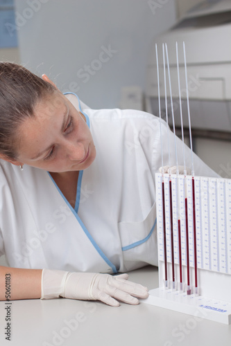 Woman doctor doing erythrocyte sedimentation rate test