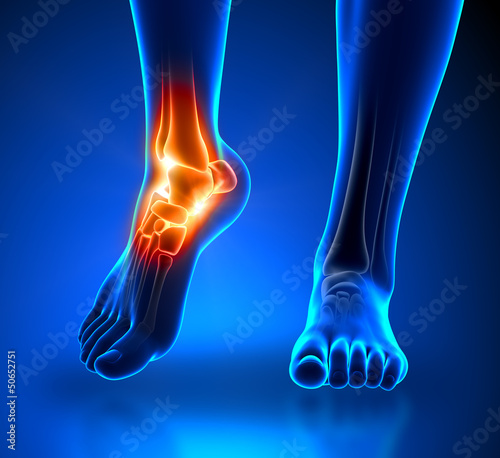 Ankle pain - detail photo