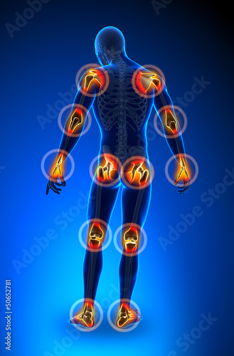 Joints pain - full figure