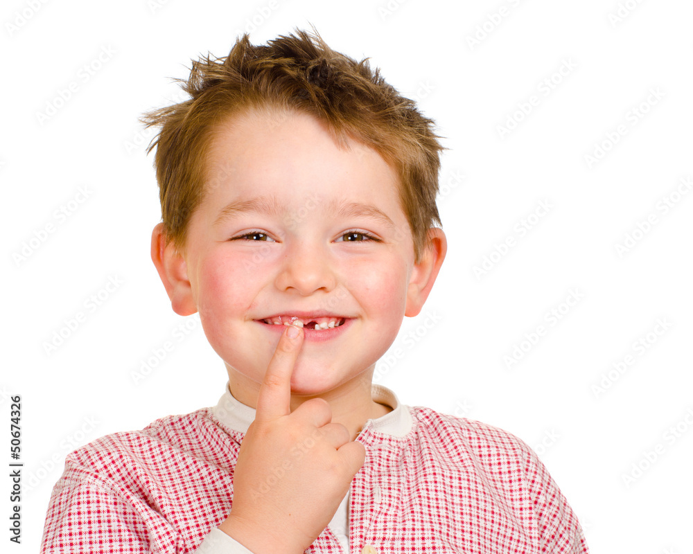 Child showing off his lost teeth isolated on white Child showing off his lost teeth isolated on white