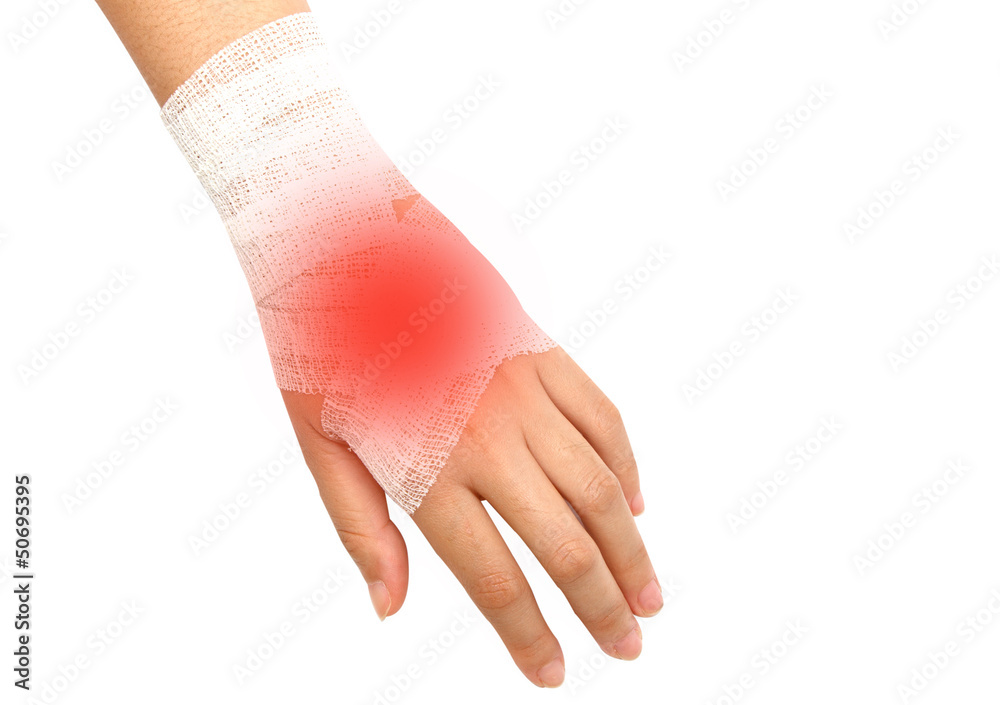 hand injury ,wrist strain ,sprained in white bandage Stock Photo | Adobe  Stock