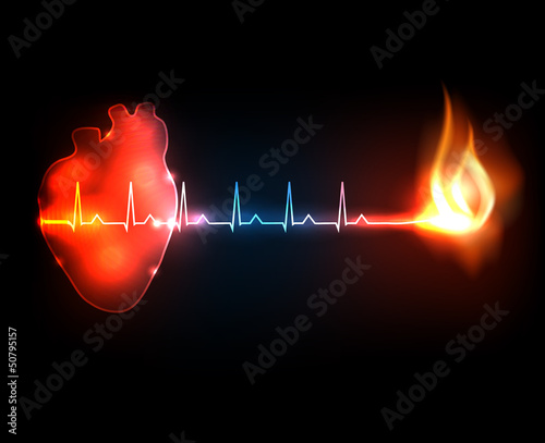 Burning cardiogram