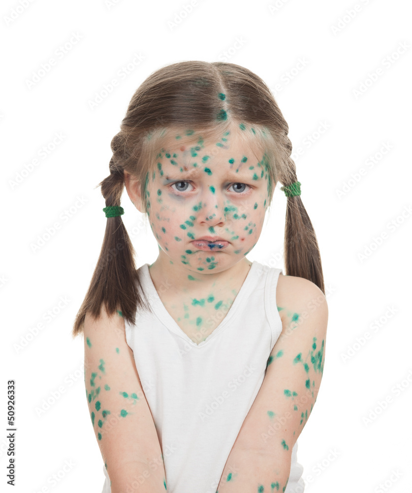 Naklejka premium sick child. chickenpox