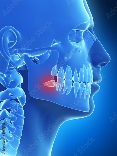 3d rendered illustration of the wisdom teeth