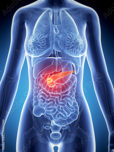 3d rendered illustration of the female anatomy - pancreas cancer