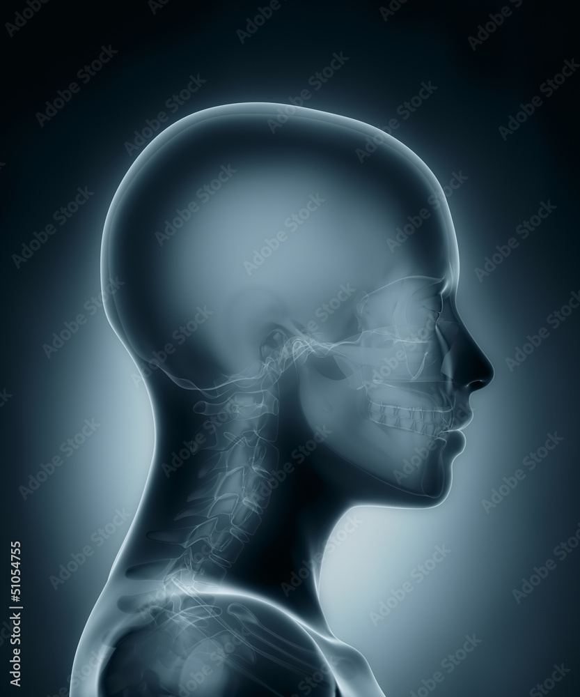 Obraz premium Skull medical x-ray scan