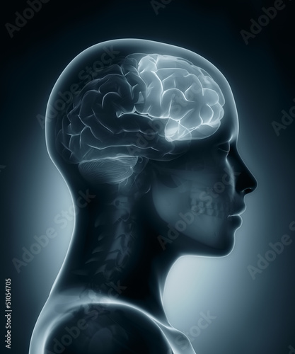 Frontal lobe medical x-ray scan