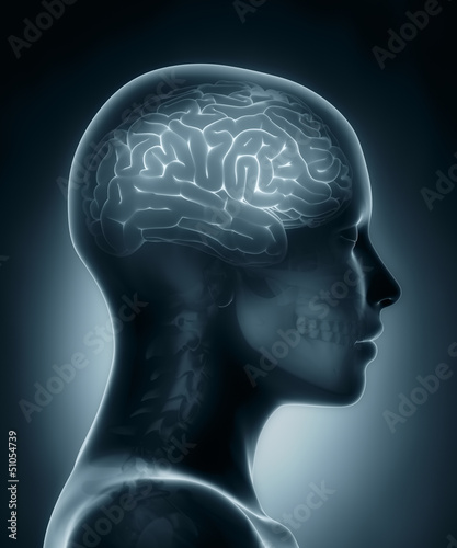 Female brain medical x-ray scan
