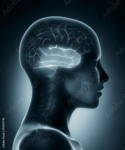 Temporal lobe medical x-ray scan