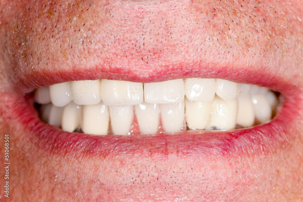 Obraz premium Prosthesis