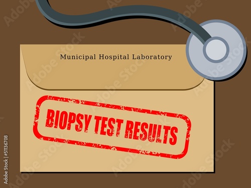Biopsy test results - medical concept vector