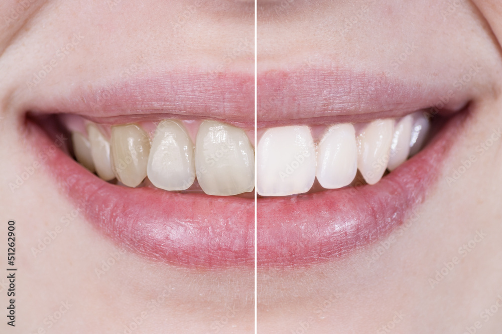 tratamiento dental