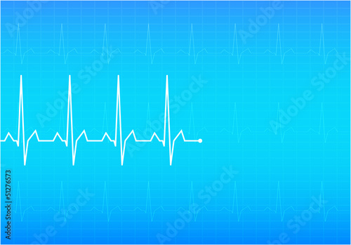 ECG Electrocardiogram, vector