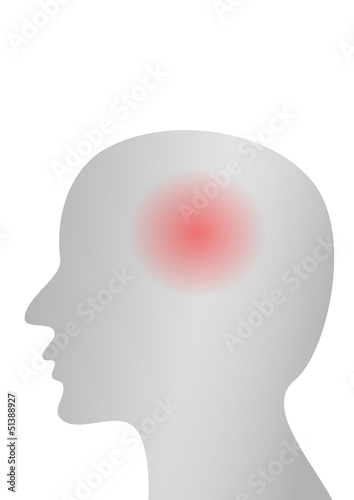 headache