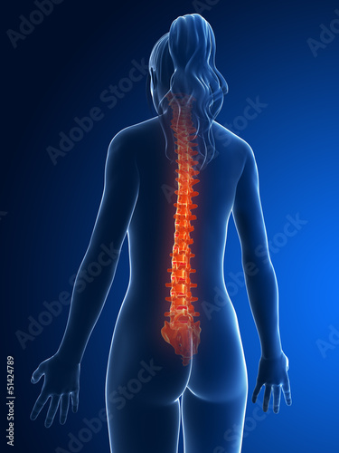 3d rendered medical illustration - painful spine photo