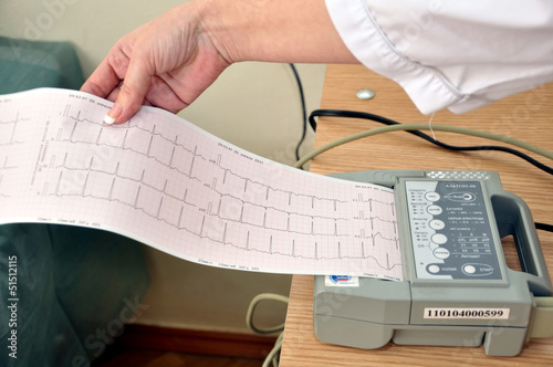 Миллиметровка с графиком сердечных ритмов пациента