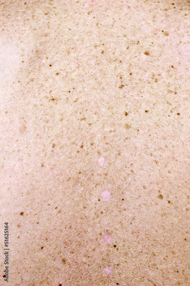 surface of the human skin surface of the human skin