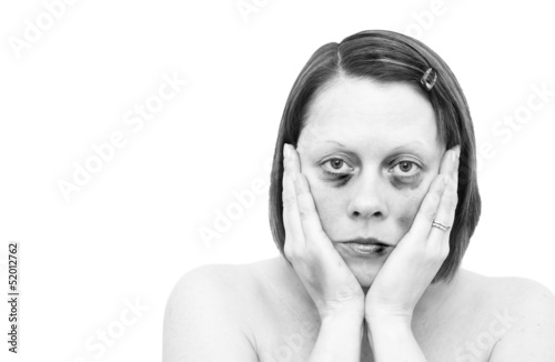female victim of assault looking ahead with head in hands