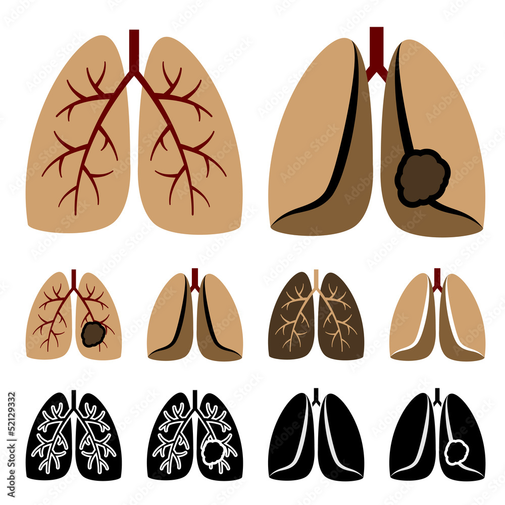 vector human lung cancer icons vector human lung cancer icons