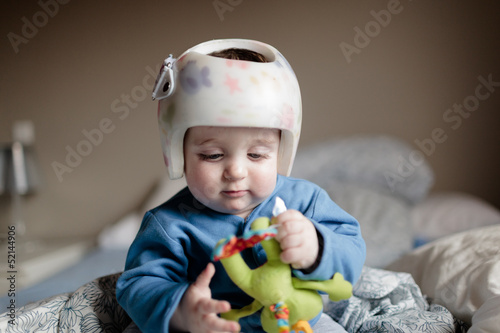 baby with helment for  Plagiocephaly