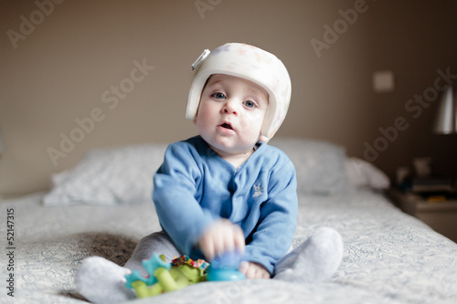 baby with helment for  Plagiocephaly