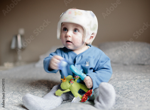 baby with helment for  Plagiocephaly