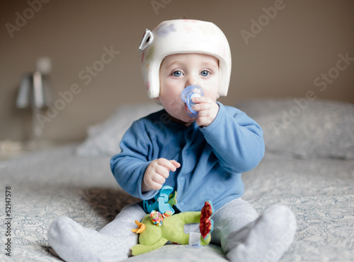 baby with helment for  Plagiocephaly