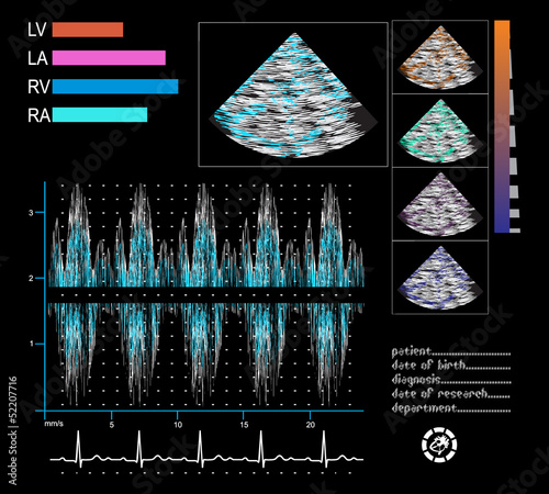 ultrasound screen.  phonocardiogram, electrocardiogram.