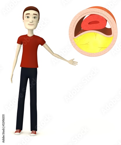 3d render of cartoon character with vein with cholesterol