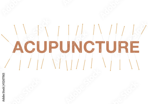 Acupuncure