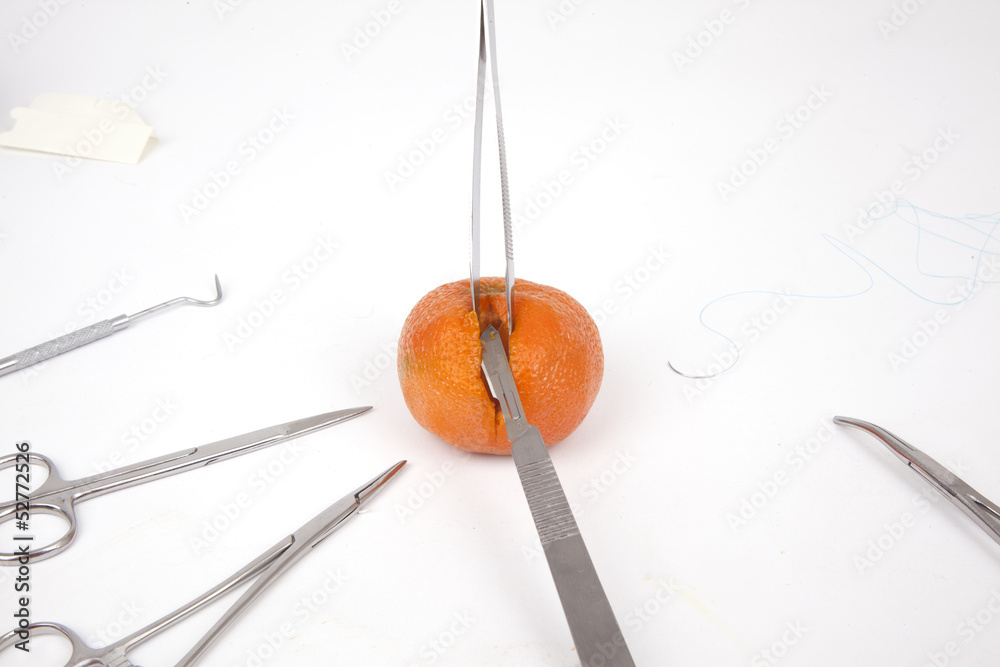 Surgery on a Orange Surgery on a Orange