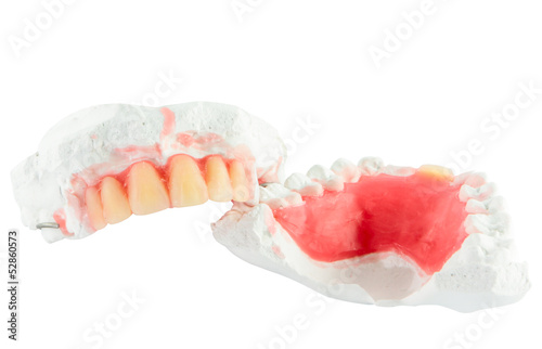 Denture teeth with wax model isolate