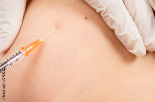 have to look perfect body