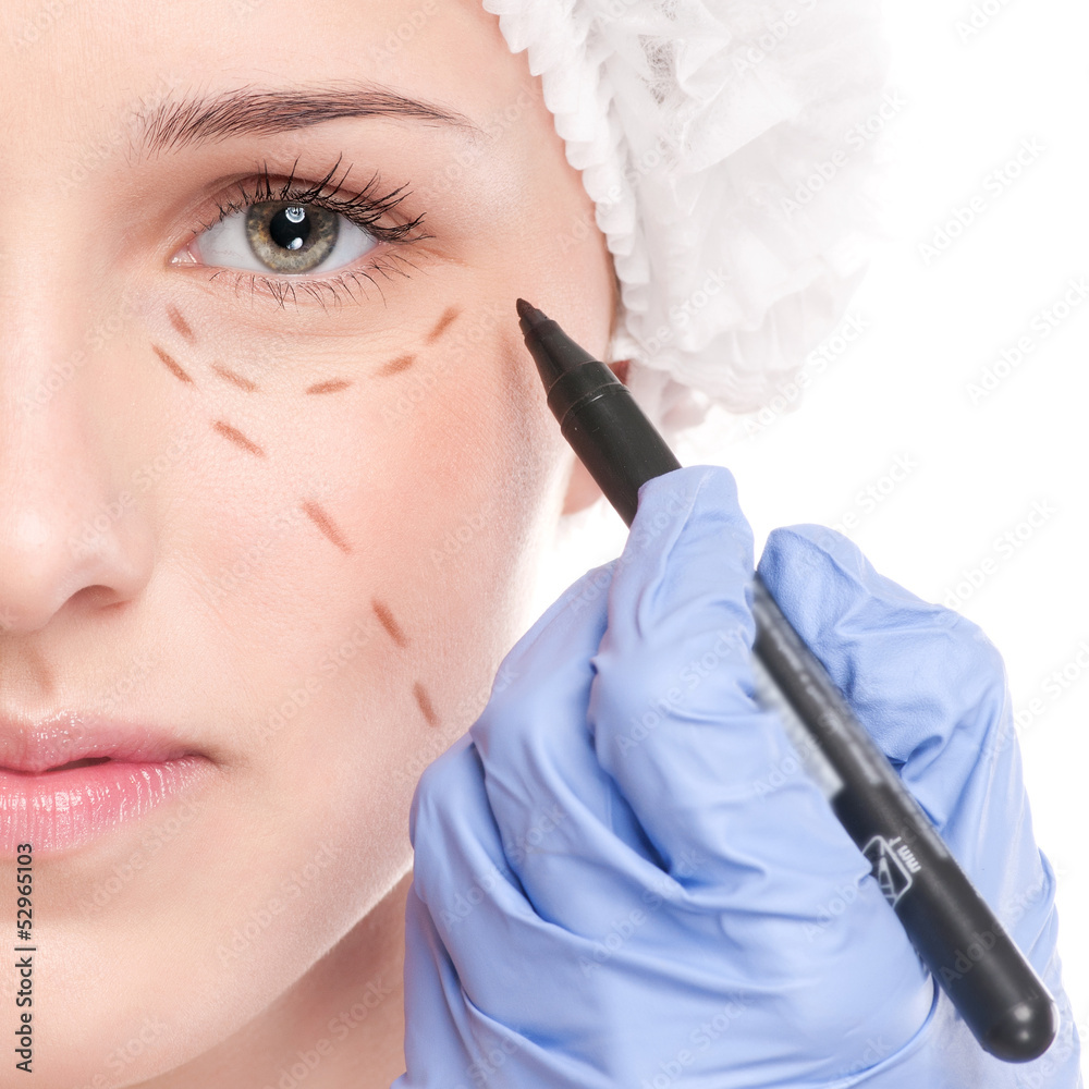 © mr.markin - Beautician draw correction lines on woman face
