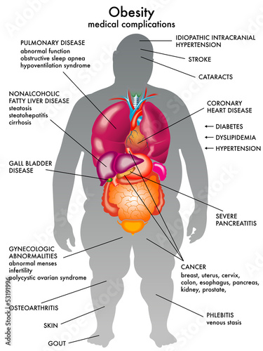 obesità photo