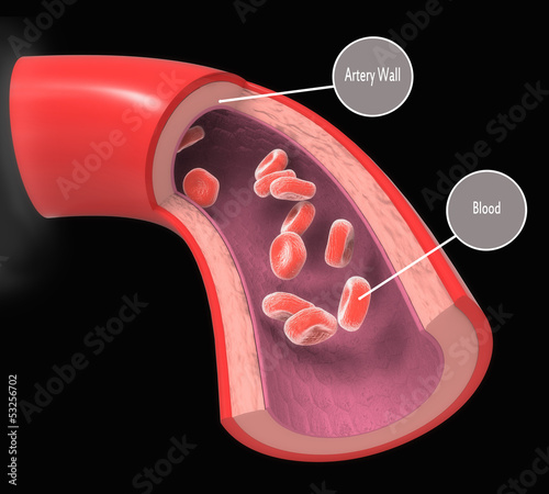 Normal  artery