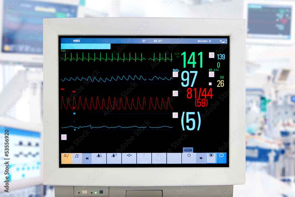 Electrocardiogram monitor Electrocardiogram monitor