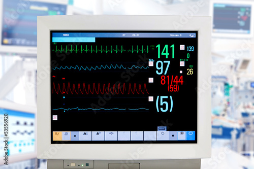 Electrocardiogram monitor