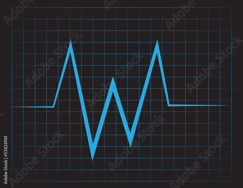 EKG grid with blue lines
