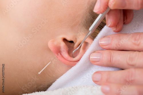 Homeopath treating woman with acupuncture.