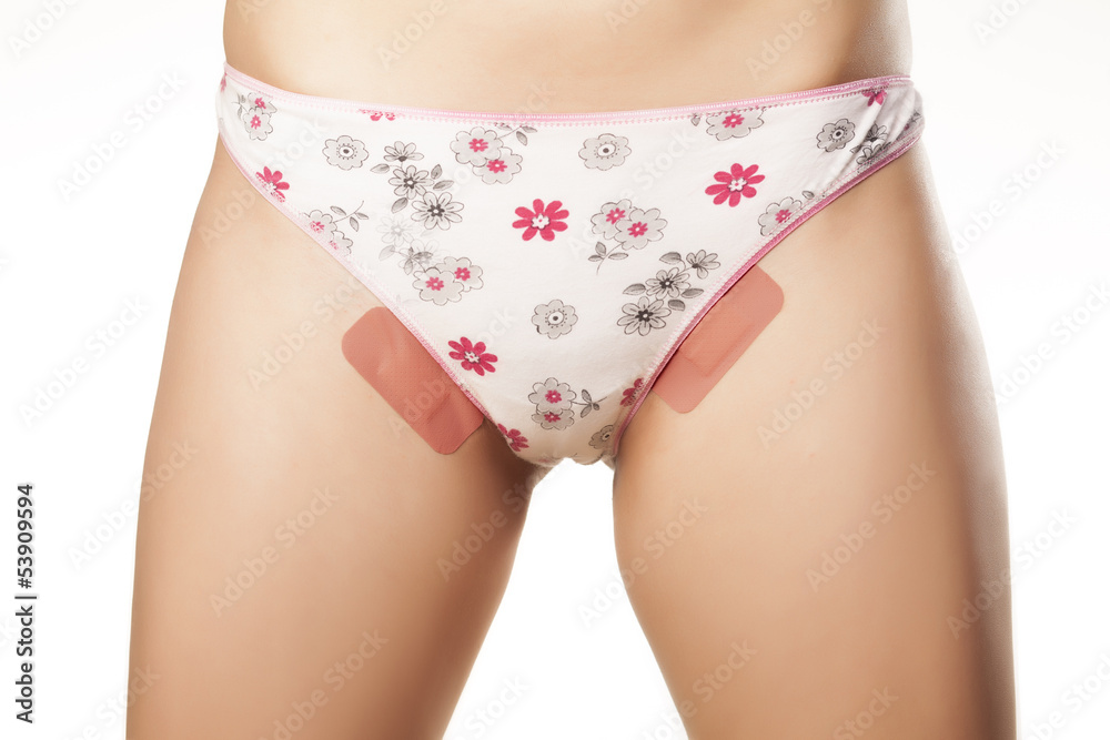 Adhesive plasters to the groin because of a problem with waxing Adhesive plasters to the groin because of a problem with waxing