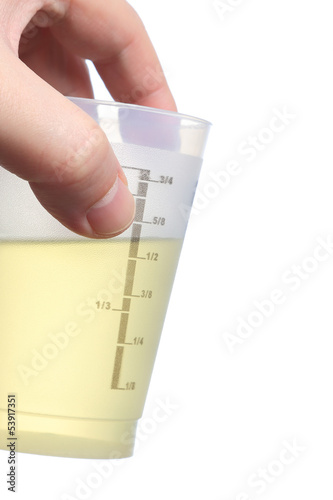 Holding urine sample