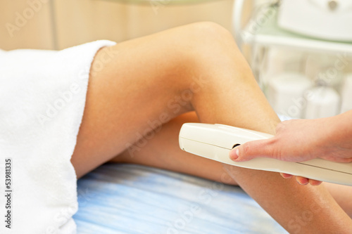 laser epilation