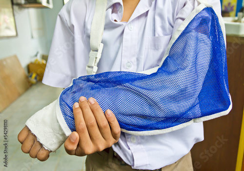 student's arm is broken